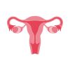 PCOD/PCOS